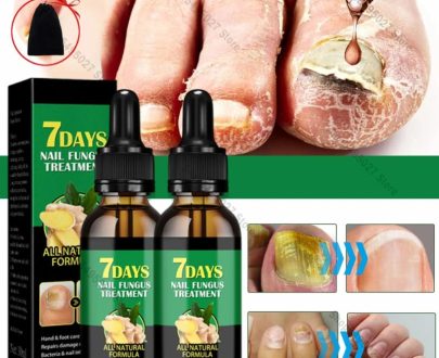 Consumer Electronics | 30Ml Repair Nail Fungus Treatments Essence Foot Care Serum Toe Nails Fungal Removal Gel Anti-Infection Onychomycosis Care Tool Consumer Electronics Consumer Electronics