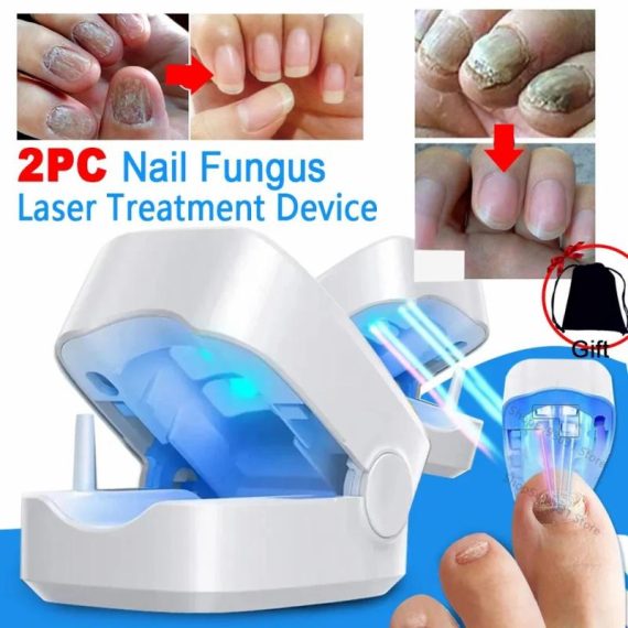 Consumer Electronics | Nail Fungus Laser Treatment Device Repair Toenail Fingernail Fungus Treat Onychomycosis Therapy Cure Machine Effectively Remove Consumer Electronics Consumer Electronics