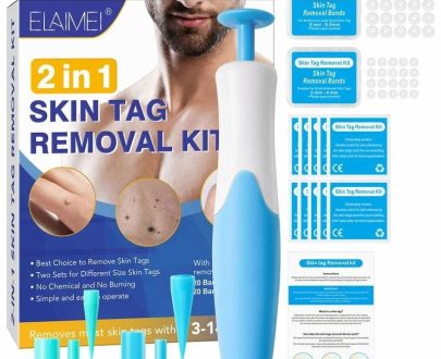 Consumer Electronics | Skin Tag Remover Kit Mole Wart Remover Equipment Skin Tag Treatment Tool Facial Beauty Tool Home Use Easy To Clean Consumer Electronics Consumer Electronics