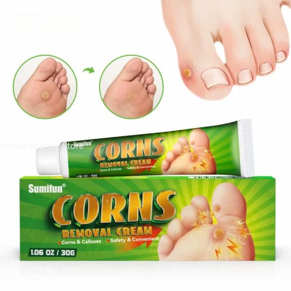 Health & Beauty | Foot Corn Remover Cream Chicken Eye Skin Infection Treatment Ointment Feet Dead Skin Calluses Removal Tool Health Care 내성발톱 Consumer Electronics Consumer Electronics