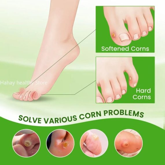 Health & Beauty | Foot Corn Remover Cream Chicken Eye Skin Infection Treatment Ointment Feet Dead Skin Calluses Removal Tool Health Care 내성발톱 Consumer Electronics Consumer Electronics