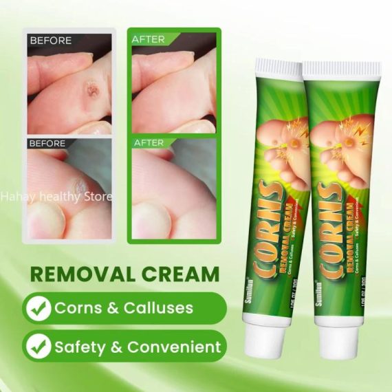 Health & Beauty | Foot Corn Remover Cream Chicken Eye Skin Infection Treatment Ointment Feet Dead Skin Calluses Removal Tool Health Care 내성발톱 Consumer Electronics Consumer Electronics