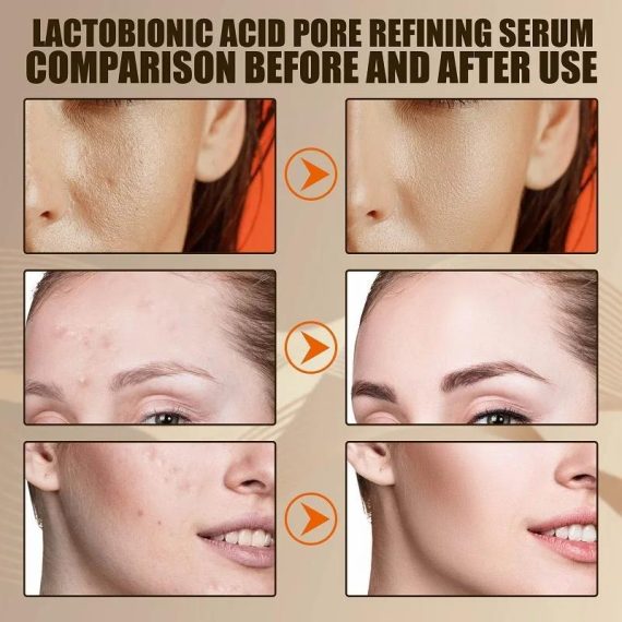 Health & Beauty | Lactobionic Acid Shrink Pores Facial Serum Firm Moisturizing Essence Liquid Repair Face Pores Beauty Skin Care Korean Cosmetics Consumer Electronics Consumer Electronics