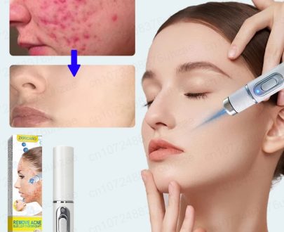 Health & Beauty | Laser Pen Skin Cleaner Removes Blackheads Exfoliates Facial Cleansing Spatula Deep Cleanses Facial Lift Removes Pores Acne Consumer Electronics Consumer Electronics